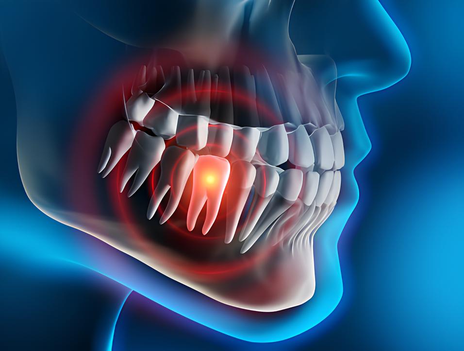Teeth image - Emergency dentist Harpenden