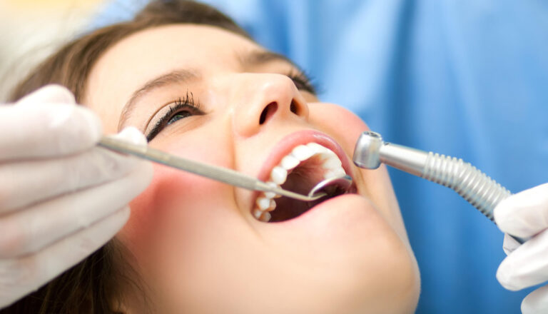 What to know about tooth extraction